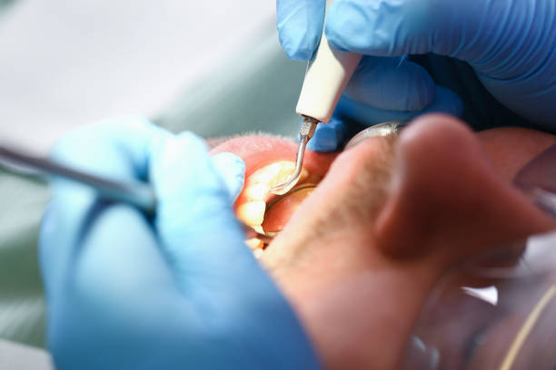 Best Emergency Tooth Extraction in Tioga, ND
