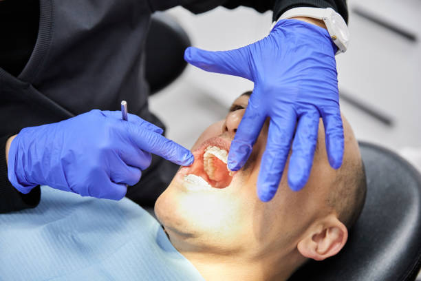 Best Emergency Gum Treatment in Tioga, ND